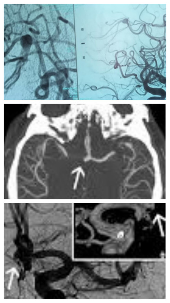 FURTHER TESTING ON THE HORIZON